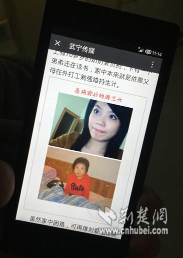 25岁少女患怪病“逆生长” 半年矮了13厘米(图)